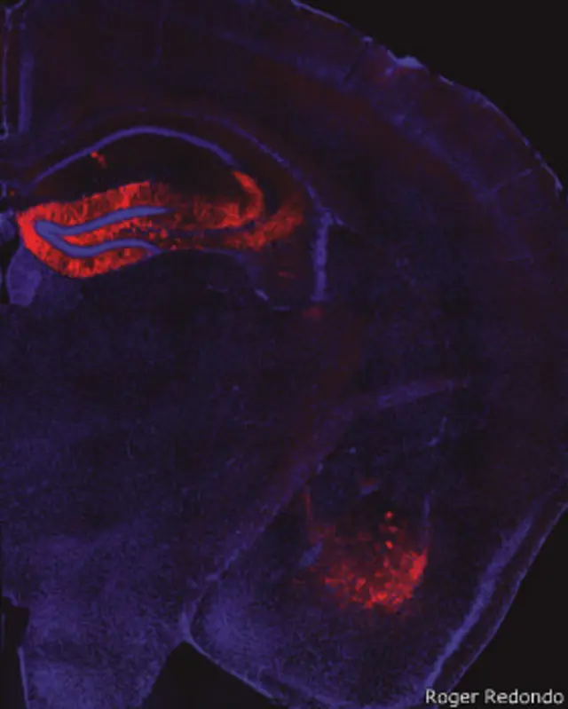 Neuronas del hipocampo de un ratón
