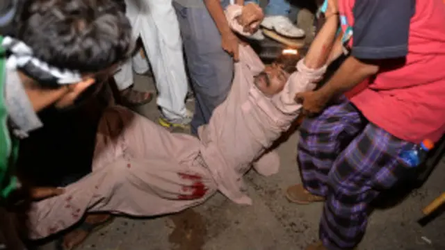 طبی حکام کے مطابق شیلنگ کے نتیجے میں 18 افراد زخمی ہو گئے ہیں