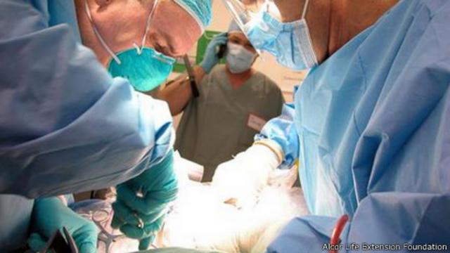 جراحون يقومون بتصفية جثة من السوائل، واستبدال ذلك بمحلول يمنع تكون كتل ثلجية داخل الخلايا