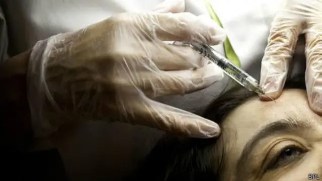 Tratamiento con botox