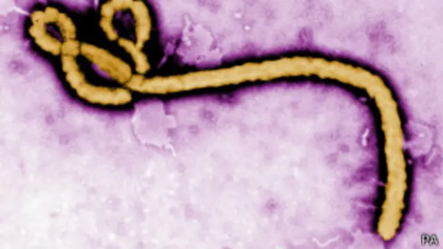 Virus del Ébola