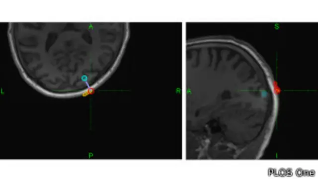 Imagen del cerebro durante experimento de telepatía