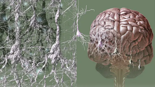 மூளை அழுகல் நோய் என்பது மிகப்பெரும் சவாலாக உருவெடுப்பதாக எச்சரிக்கை