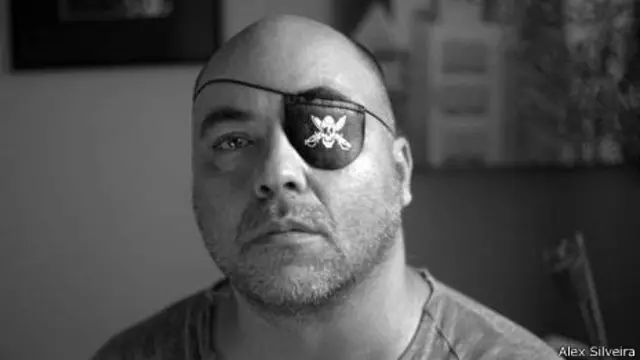 O fotógrafo Alex Silveira, que perdeu 80% da visão após tiro de borracha