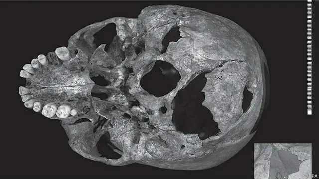 Череп короля Ричарда со следами ранений