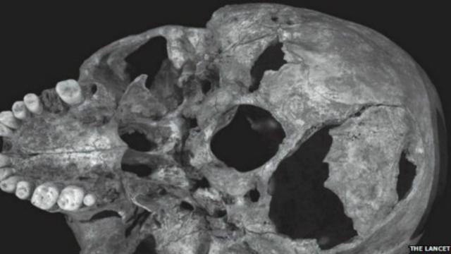 Cráneo de Ricardo III