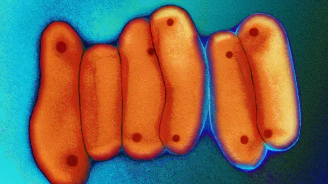 Туберкульоз