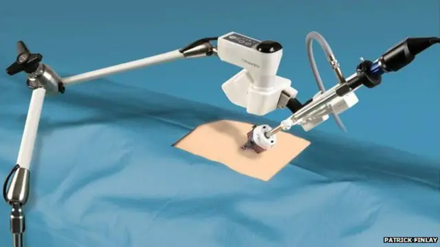 Los robots pueden las cirugías una experiencia mucho menos traumática, con heridas que sólo necesitan tiritas.