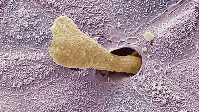 جرم یا موم گوش از یک غده در کانال گوش ترشح می شود