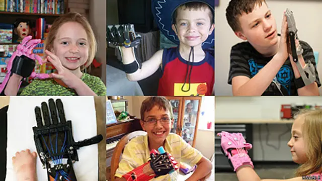 Niños con prótesis de Enable