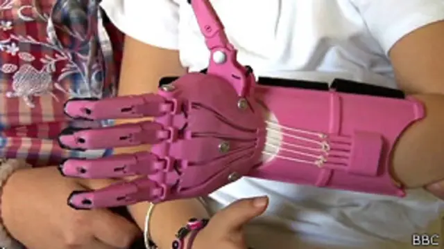 थ्री-डी प्रिंटेड तकनीक से बना हेले का गुलाबी हाथ