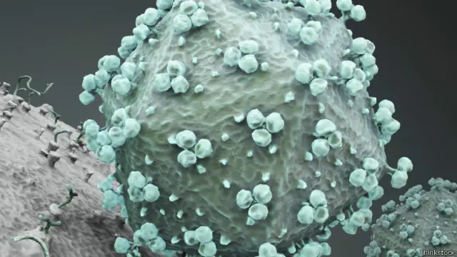 HIV (Thinkstock)