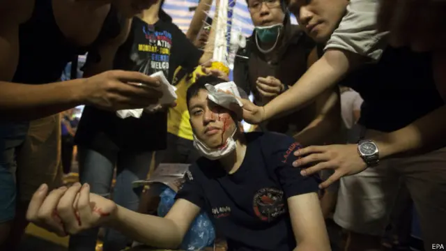 Seorang mahasiswa pro-demokrasi terluka dalam bentrokan dengan demonstran tandingan.
