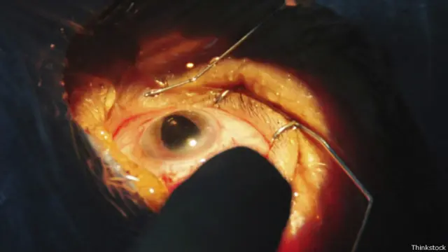 восстановление зрения