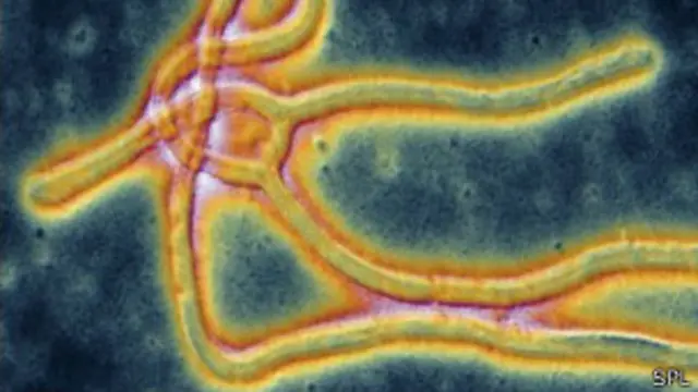 इबोला वायरस