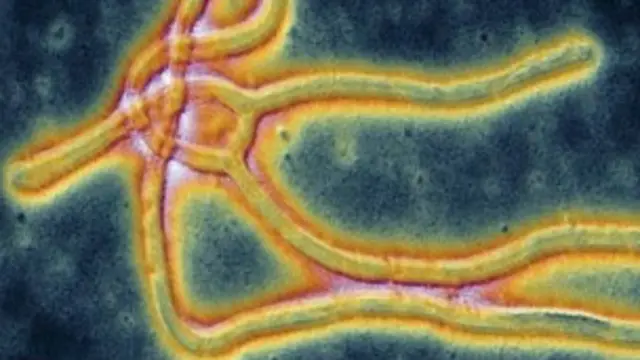 تا به حال حدود ۳۴۰۰ نفر جان خود را به علت ابولا از دست داده‌اند