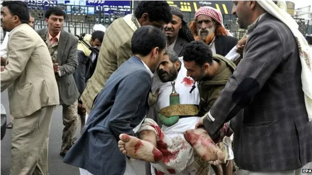 صنعا میں ہونے والے حملے کی ذمہ داری کسی نے قبول نہیں کی ہے