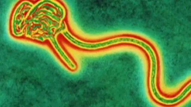 вірус Ебола