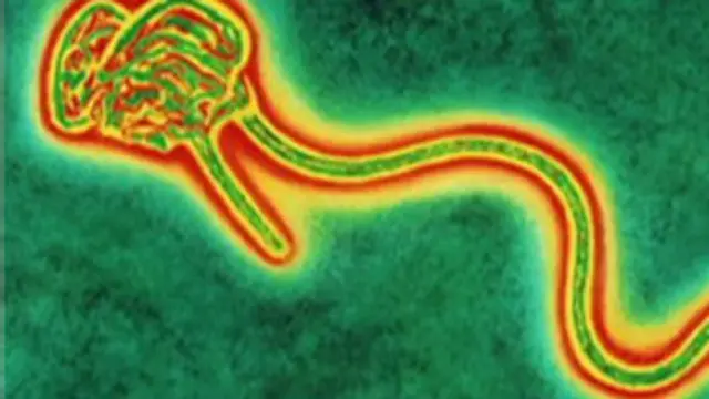 इबोला वायरस