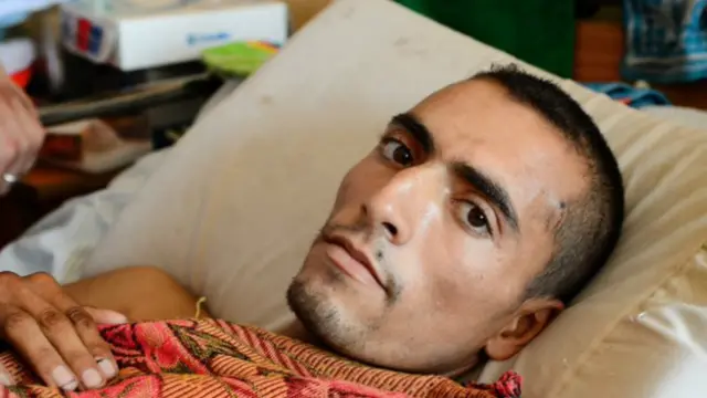 دھماکے میں عبداللہ کی ٹانگ اس بری طرح زخمی ہوئی کہ اسے جسم سے الگ کرنا پڑا