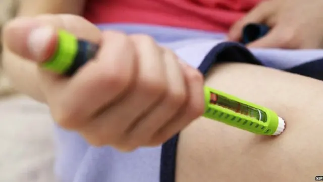 Perempuan cenderung hidup lebih lama dari pria, tapi tidak bagi perempuan pengidap diabetes tipe 1