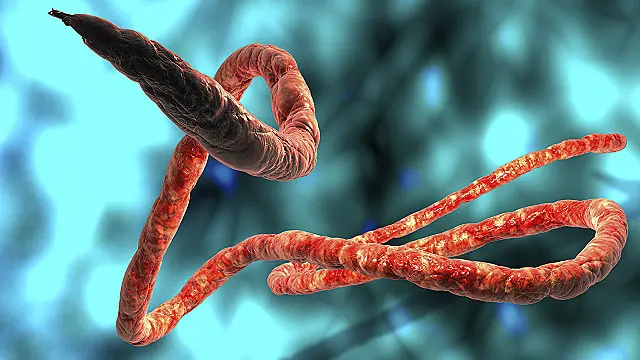 Tình hình Ebola đang diễn biến phức tạp trên thế giới