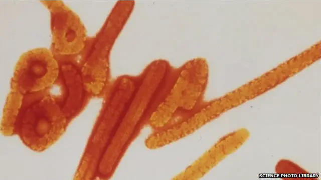 इबोला वायरस