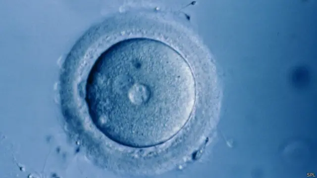 تخمک بارور شده انسان
