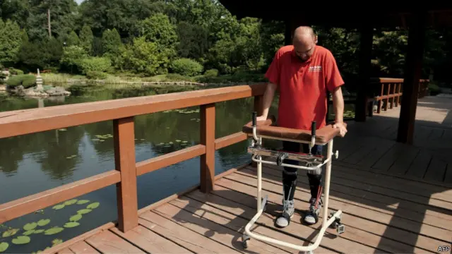 آقای فیدیکا اولین بیمار مبتلا به فلج نخاعی است که بعد از قطع کامل نخاع علائم بهبودی نشان داده است