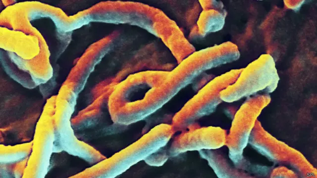 ایبولا کے مرض سے اب تک ساڑھے چار ہزار سے زائد افراد ہلاک ہو چکے ہی