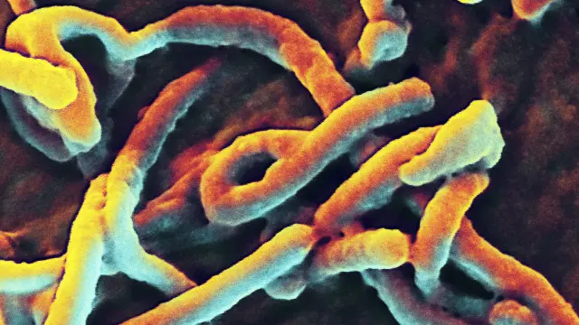 Virus Ebola đang là nỗi kinh hoàng ở châu Phi
