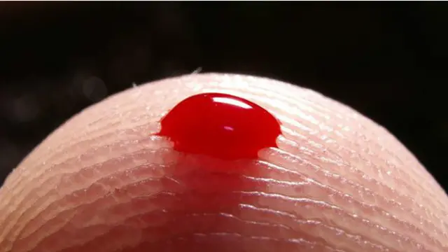 Com poucas gotas de sangue, app poderá determinar se pessoa tem ebola