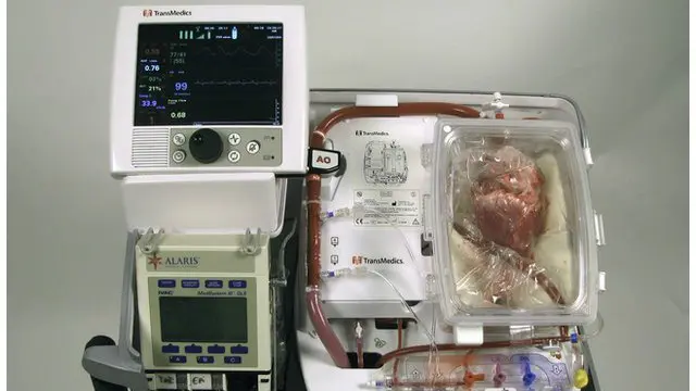 ٹرانسپلانٹ