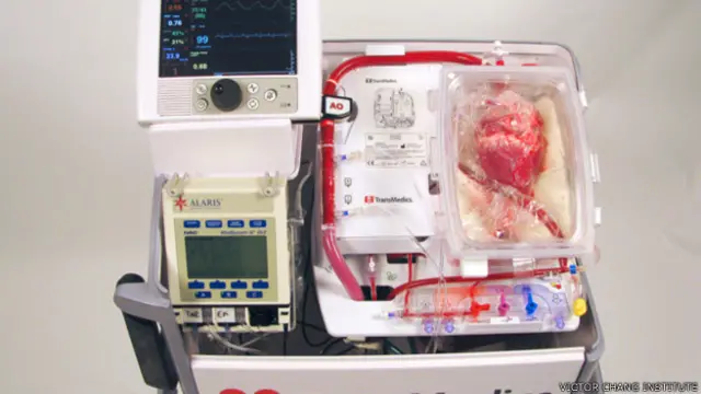 "Сердце в коробке"