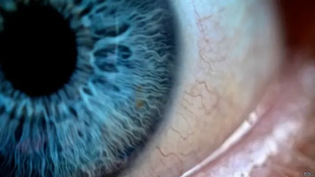 Alzheimer's eye diagnosis