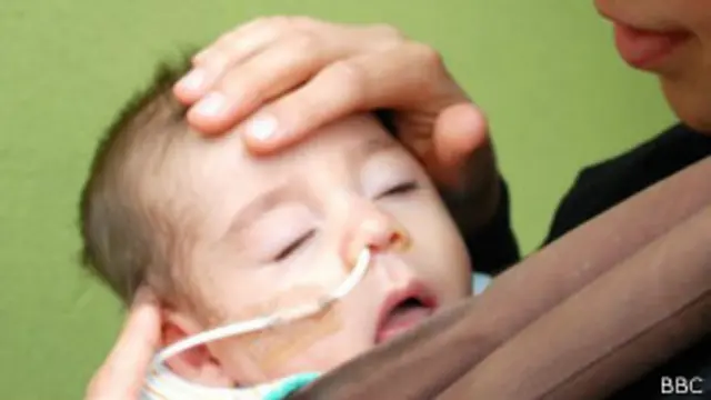 La droga tambien serviría para tratar casos de epilepsia como el de Lucas, que sufría hasta 300 convulsiones diarias.