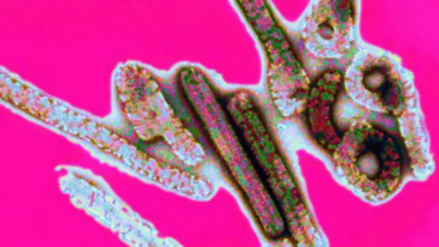 इबोला का संक्रमण