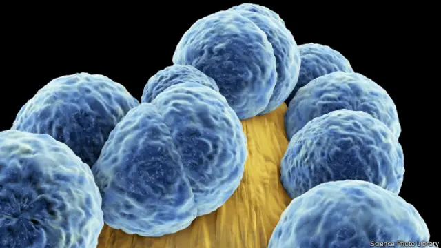 Метициллин-резистентный стафилококк 