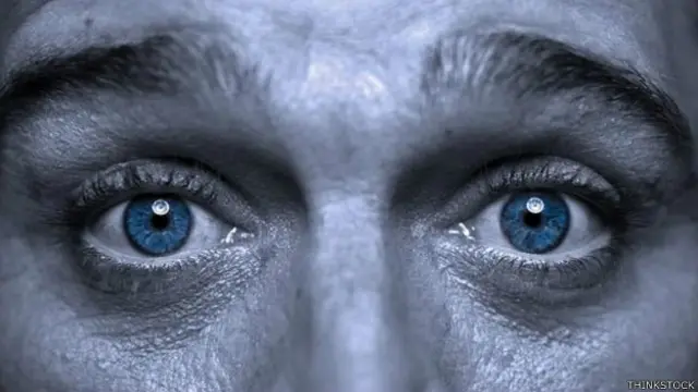 Cegueira estéreo faz com que pessoas só consigam ver o mundo em um plano, sem profundidade