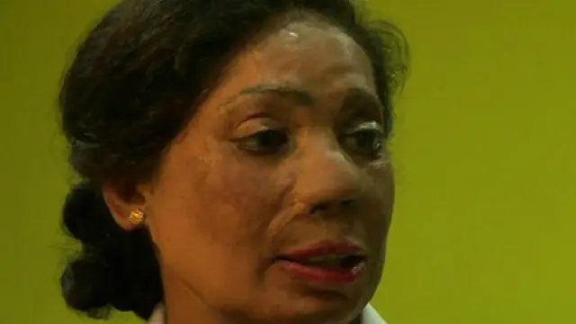 بشرا وايي خسرګنۍ یې ورباندې په دې خاطر تېزاب وپاشل چې ولې یې په جهیز کې ډېرې پیسې د خاوند کور ته نه وې وړې. 