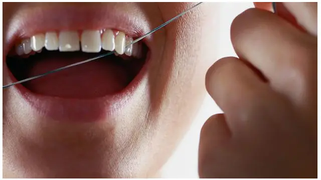 Hiện chưa rõ việc dùng chỉ nha khoa có ích lợi đến đâu