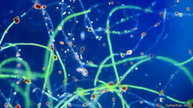 الأكياس الحمضية (ذات اللون الأحمر) لميكروبات "فامبيرلا لاتريتيا" تظهر فوق الطحالب (ذات اللون الأخضر)