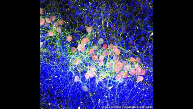 Друге місце посіла Ніколя Драммонд з Університету Единбурга за це зображення під назвою "Водяні лілії", яке показує, як у мозку накопичується протеїн. 