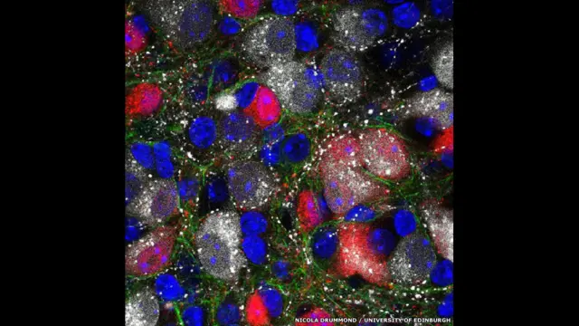 Нейрони мозку у всій красі. Вчені вміють підтримувати ці клітини в живому стані у лабораторії протягом кількох місяців, проводячи над ними досліди. 