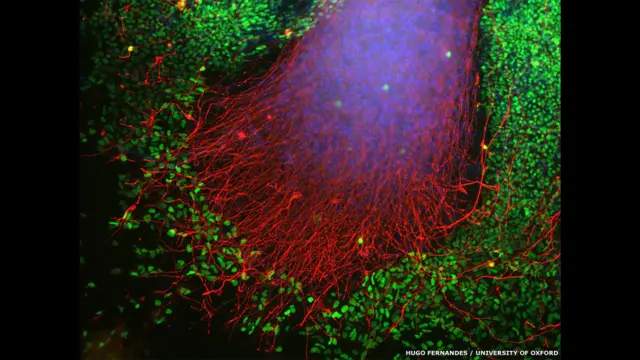 Так виглядають клітини шкіри на самому початку процесу їхнього перетворення на нейрони. Автор - Г'юґо Фернандес, Оксфорд. 