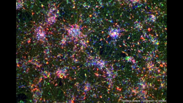 Зелені плями означають, що ці клітини, створені з клітин шкіри, дійсно є нейронами, пояснює Федеріко Замбон, теж з Оксфорда. 