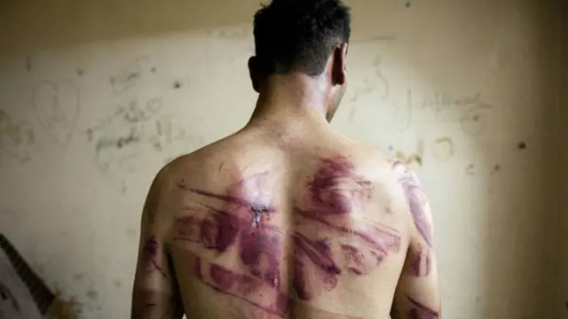 اکثر قیدیوں کو جیلوں میں آنے کے فوراً بعد محافظوں کی جانب سے شدید تشدد کا سامنا کرنا پڑا