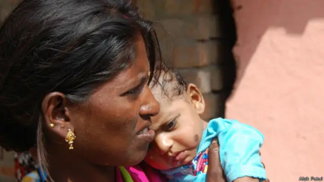 छत्तीसगढ़, महिला नसबंदी