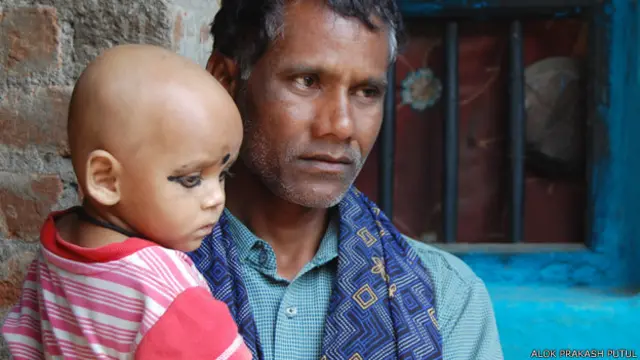 छत्तीसगढ़, नसबंदी मामला