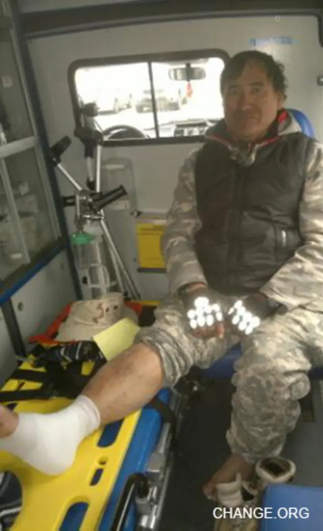 Ignacio Jaime Camacho, un chileno de 51 años que recorre el país en muletas.